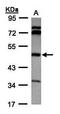 Betaine--Homocysteine S-Methyltransferase antibody, orb69963, Biorbyt, Western Blot image 