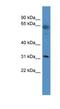 Olfactory Receptor Family 2 Subfamily T Member 29 antibody, NBP1-69037, Novus Biologicals, Western Blot image 