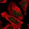 Telomeric Repeat Binding Factor 2 antibody, NBP1-86911, Novus Biologicals, Immunofluorescence image 