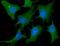 Cofilin 1 antibody, NBP1-21044, Novus Biologicals, Immunocytochemistry image 