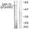 Zeta Chain Of T Cell Receptor Associated Protein Kinase 70 antibody, LS-C199743, Lifespan Biosciences, Western Blot image 