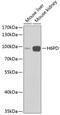 Hexose-6-Phosphate Dehydrogenase/Glucose 1-Dehydrogenase antibody, GTX54162, GeneTex, Western Blot image 