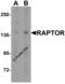 Regulatory Associated Protein Of MTOR Complex 1 antibody, 3491, ProSci, Western Blot image 
