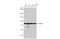Ezrin antibody, GTX111709, GeneTex, Western Blot image 