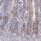 Follicle Stimulating Hormone Subunit Beta antibody, NBP2-57723, Novus Biologicals, Immunohistochemistry frozen image 