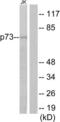 Tumor Protein P73 antibody, LS-B6714, Lifespan Biosciences, Western Blot image 