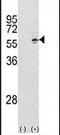 Chaperonin Containing TCP1 Subunit 3 antibody, PA5-12523, Invitrogen Antibodies, Western Blot image 