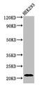 Activating Transcription Factor 3 antibody, CSB-PA002271EA01HU, Cusabio, Western Blot image 