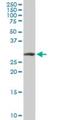 Actin Related Protein 2/3 Complex Subunit 2 antibody, H00010109-M01, Novus Biologicals, Western Blot image 