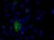 Natriuretic Peptide Receptor 3 antibody, MA5-25065, Invitrogen Antibodies, Immunocytochemistry image 