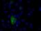 Natriuretic Peptide Receptor 3 antibody, MA5-25065, Invitrogen Antibodies, Immunocytochemistry image 