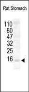 Trefoil Factor 3 antibody, 251187, Abbiotec, Western Blot image 