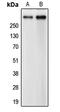 Centrosomal Protein 290 antibody, MBS821200, MyBioSource, Western Blot image 