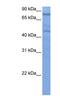 Zinc Finger Protein 555 antibody, NBP1-80419, Novus Biologicals, Western Blot image 