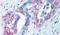 Transient Receptor Potential Cation Channel Subfamily M Member 8 antibody, PA5-34287, Invitrogen Antibodies, Immunohistochemistry paraffin image 
