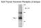 Thyroid Hormone Receptor Beta antibody, GTX82578, GeneTex, Western Blot image 