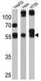 Cytochrome P450 Family 3 Subfamily A Member 7 antibody, GTX79463, GeneTex, Western Blot image 
