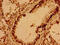 Vesicle Associated Membrane Protein 7 antibody, CSB-PA025785LA01HU, Cusabio, Immunohistochemistry frozen image 