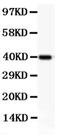 Integrin Subunit Beta 2 antibody, PA5-79538, Invitrogen Antibodies, Western Blot image 
