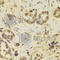 Docking Protein 1 antibody, A5687, ABclonal Technology, Immunohistochemistry paraffin image 