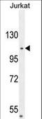 Centromere Protein C antibody, LS-C168664, Lifespan Biosciences, Western Blot image 