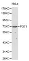 Protection Of Telomeres 1 antibody, abx001265, Abbexa, Western Blot image 