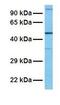 Interleukin-28 receptor subunit alpha antibody, GTX46261, GeneTex, Western Blot image 