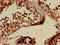 Clathrin Heavy Chain Like 1 antibody, LS-C318069, Lifespan Biosciences, Immunohistochemistry paraffin image 