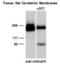 Glutamate Metabotropic Receptor 2 antibody, PA1-46113, Invitrogen Antibodies, Western Blot image 