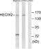 E3 ubiquitin-protein ligase HECW2 antibody, A08779, Boster Biological Technology, Western Blot image 