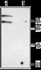 Chloride Voltage-Gated Channel Kb antibody, GTX16636, GeneTex, Western Blot image 