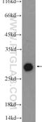 DnaJ Heat Shock Protein Family (Hsp40) Member B6 antibody, 11707-1-AP, Proteintech Group, Western Blot image 
