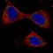 Protein Phosphatase 3 Catalytic Subunit Beta antibody, HPA008823, Atlas Antibodies, Immunofluorescence image 