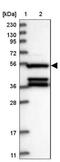 Secretion Regulating Guanine Nucleotide Exchange Factor antibody, NBP1-88025, Novus Biologicals, Western Blot image 