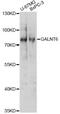 Polypeptide N-Acetylgalactosaminyltransferase 6 antibody, LS-C749836, Lifespan Biosciences, Western Blot image 
