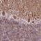 Transcription Factor 20 antibody, PA5-57816, Invitrogen Antibodies, Immunohistochemistry paraffin image 