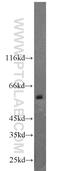 Calcium/Calmodulin Dependent Protein Kinase Kinase 2 antibody, 11549-1-AP, Proteintech Group, Western Blot image 