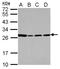Proteoglycan 2, Pro Eosinophil Major Basic Protein antibody, NBP2-19928, Novus Biologicals, Western Blot image 