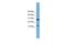 T-cell acute lymphocytic leukemia protein 2 homolog antibody, A12166, Boster Biological Technology, Western Blot image 