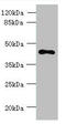 Transmembrane Protein 59 Like antibody, A61434-100, Epigentek, Western Blot image 