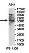 Dynein Regulatory Complex Subunit 3 antibody, orb78450, Biorbyt, Western Blot image 