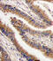 Protein Kinase X-Linked antibody, 63-299, ProSci, Immunohistochemistry paraffin image 