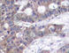 Stathmin 1 antibody, AP0229, ABclonal Technology, Immunohistochemistry paraffin image 