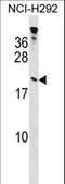 TPPP antibody, LS-C160143, Lifespan Biosciences, Western Blot image 