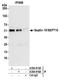 Septin 10 antibody, A304-915A, Bethyl Labs, Immunoprecipitation image 