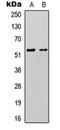 Potassium Two Pore Domain Channel Subfamily K Member 3 antibody, orb315796, Biorbyt, Western Blot image 