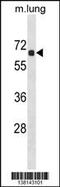 Acyl-CoA Thioesterase 9 antibody, 59-994, ProSci, Western Blot image 