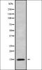 TGFB1-Induced Anti-Apoptotic Factor 1 antibody, orb337831, Biorbyt, Western Blot image 