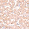 ATP Binding Cassette Subfamily B Member 7 antibody, LS-C749680, Lifespan Biosciences, Immunohistochemistry frozen image 