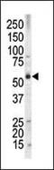 MLLT3 Super Elongation Complex Subunit antibody, PA5-13175, Invitrogen Antibodies, Western Blot image 